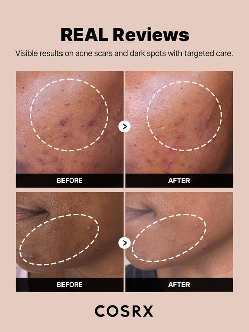 COSRX The Alpha-Arbutin 2 Discoloration Care Serum sukinnaturals sukinnaturals.com.au